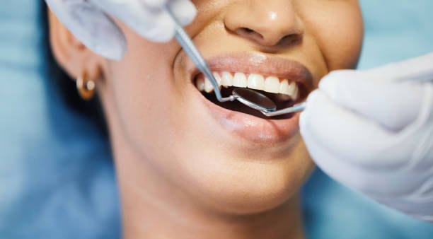 Best Emergency Dental Care for Abscessed Tooth in Davis Junction, IL
