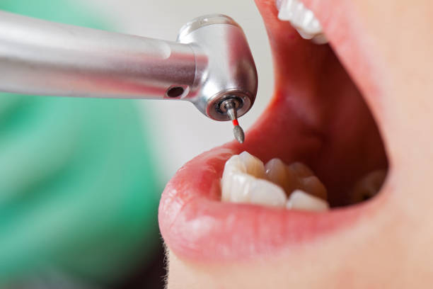 Best Emergency Dentist for Lost Fillings or Crowns in Davis Junction, IL